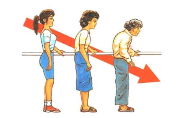 骨質(zhì)疏松的主要原因 骨質(zhì)疏松癥的好發(fā)人群 骨質(zhì)疏松的主要原因 骨質(zhì)疏松癥的好發(fā)人群