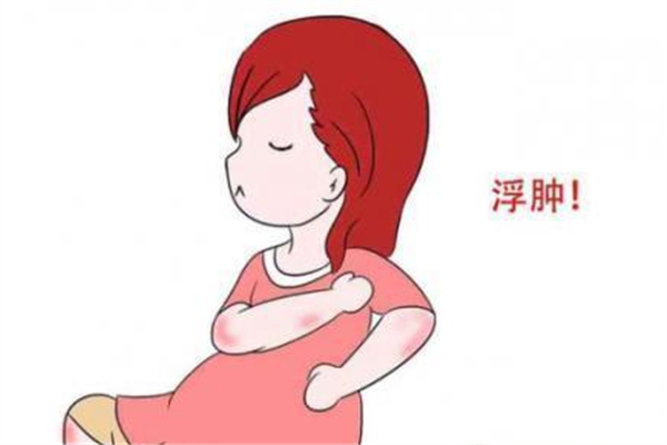 腎炎水腫怎么辦 腎炎水腫可以治好嗎 腎炎水腫怎么辦 腎炎水腫可以治好嗎