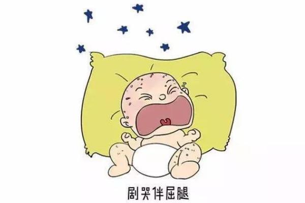 新生兒腸脹氣放屁會(huì)不會(huì)好點(diǎn) 嬰兒脹氣放屁是好了嗎 新生兒腸脹氣放屁會(huì)不會(huì)好點(diǎn) 嬰兒脹氣放屁是好了嗎