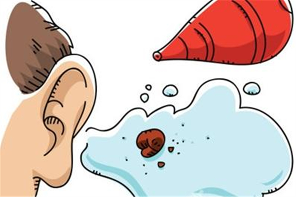 中耳炎流膿怎么辦 中耳炎流膿發(fā)臭嚴重嗎