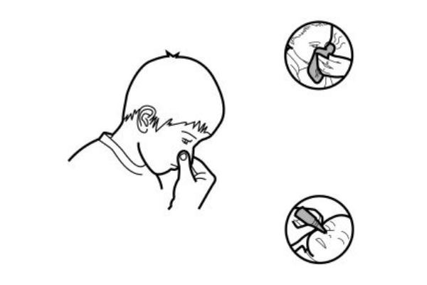 流鼻血有很大粘稠血塊 流鼻血有粘稠血塊怎么辦 流鼻血有很大粘稠血塊 流鼻血有粘稠血塊怎么辦