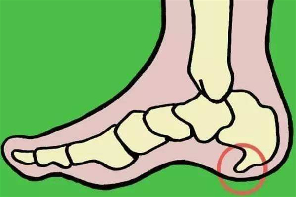 骨質(zhì)增生會(huì)腰疼和坐骨疼嗎 骨質(zhì)增生腰疼怎么緩解 骨質(zhì)增生會(huì)腰疼和坐骨疼嗎 骨質(zhì)增生腰疼怎么緩解