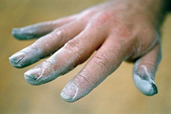 灰指甲有潛伏期嗎 灰指甲有什么癥狀 灰指甲有潛伏期嗎 灰指甲有什么癥狀