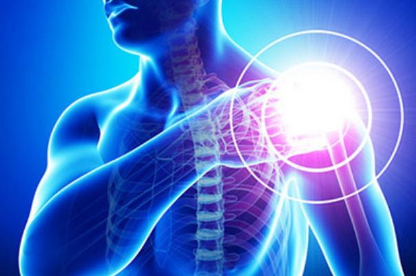 肩周炎是哪個部位痛 肩周炎是幾級疼痛 肩周炎是哪個部位痛 肩周炎是幾級疼痛