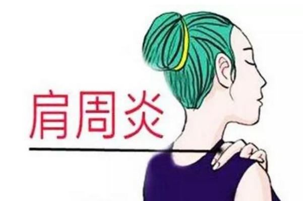 肩周炎要忌口嗎 肩周炎要?jiǎng)邮中g(shù)嗎 肩周炎要忌口嗎 肩周炎要?jiǎng)邮中g(shù)嗎