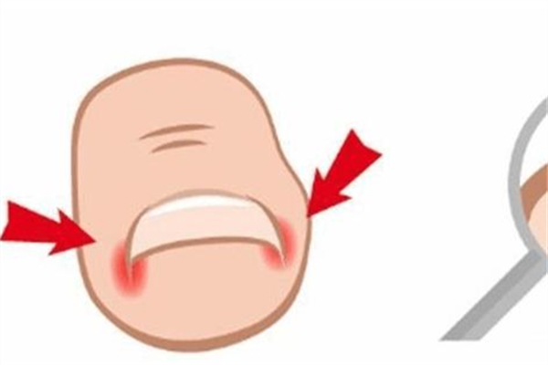 甲溝炎會自己好嗎 甲溝炎擦碘伏能好嗎 甲溝炎會自己好嗎 甲溝炎擦碘伏能好嗎