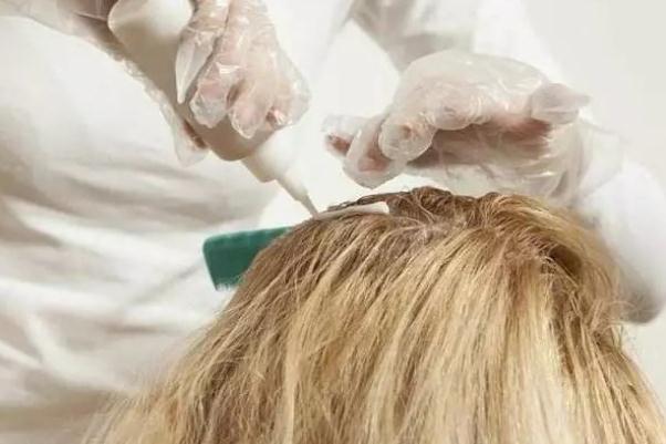 染發(fā)劑過(guò)敏會(huì)出現(xiàn)什么癥狀 染發(fā)劑過(guò)敏了怎么辦 染發(fā)劑過(guò)敏會(huì)出現(xiàn)什么癥狀 染發(fā)劑過(guò)敏了怎么辦