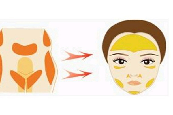 自體填充是永久的嗎 自體填充有什么危害 自體填充是永久的嗎 自體填充有什么危害