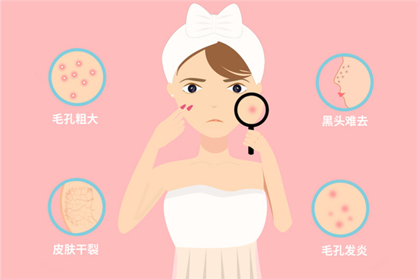 黑頭要定期清理嗎 黑頭多久清理一次比較好 黑頭要定期清理嗎 黑頭多久清理一次比較好