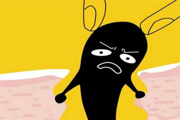 黑頭是怎么產(chǎn)生的 黑頭可以擠嗎 黑頭是怎么產(chǎn)生的 黑頭可以擠嗎