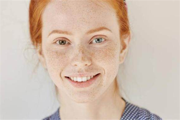 黑色素沉淀會自己消失嗎 黑色素沉淀會癢嗎 黑色素沉淀會自己消失嗎 黑色素沉淀會癢嗎