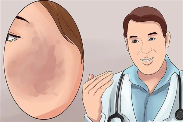 黑色素沉淀會自己消失嗎 黑色素沉淀會癢嗎 黑色素沉淀會自己消失嗎 黑色素沉淀會癢嗎