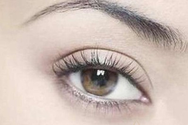 雙眼皮手術(shù)多久能恢復(fù)自然 雙眼皮手術(shù)多少錢(qián)一次 雙眼皮手術(shù)多久能恢復(fù)自然 雙眼皮手術(shù)多少錢(qián)一次