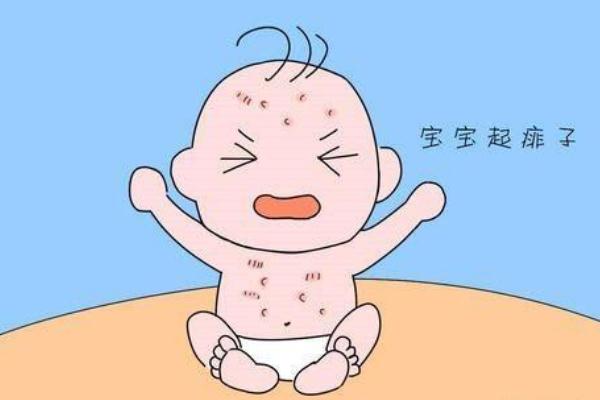寶寶長(zhǎng)痱子用什么擦效果好 寶寶長(zhǎng)痱子怎么快速消除止癢 寶寶長(zhǎng)痱子用什么擦效果好 寶寶長(zhǎng)痱子怎么快速消除止癢