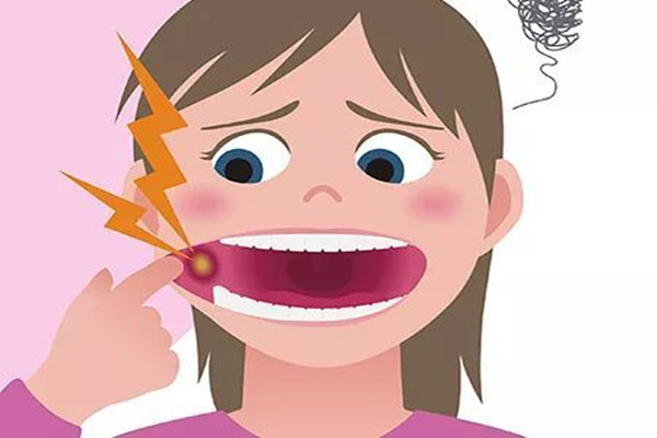 口腔潰瘍是什么癥狀 口腔潰瘍是什么原因造成 口腔潰瘍是什么癥狀 口腔潰瘍是什么原因造成