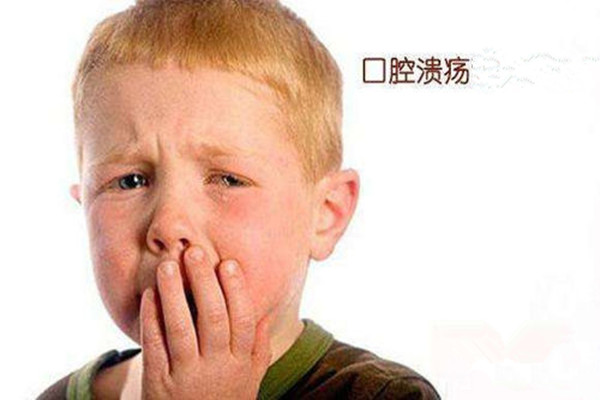 口腔潰瘍有忌口嗎 口腔潰瘍可以吃冰的東西嗎 口腔潰瘍有忌口嗎 口腔潰瘍可以吃冰的東西嗎