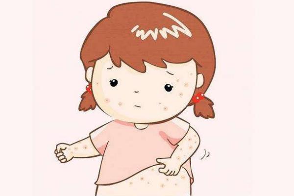 寶寶長痱子可以吃蝦嗎 寶寶長痱子可以打疫苗嗎 寶寶長痱子可以吃蝦嗎 寶寶長痱子可以打疫苗嗎