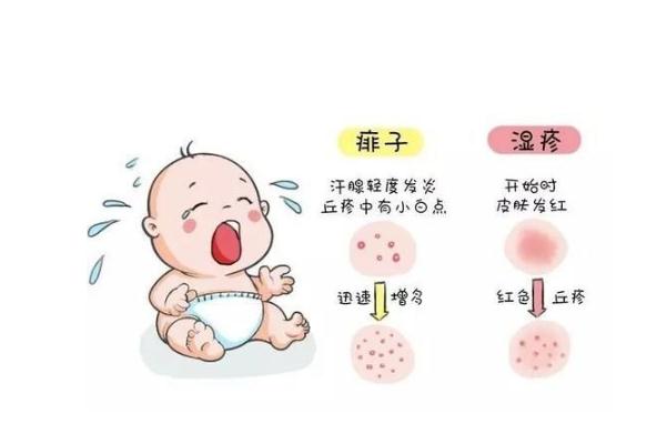 寶寶長(zhǎng)痱子用什么擦效果好 寶寶長(zhǎng)痱子怎么快速消除止癢 寶寶長(zhǎng)痱子用什么擦效果好 寶寶長(zhǎng)痱子怎么快速消除止癢
