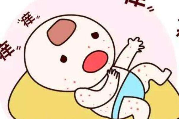 寶寶長痱子可以吃蝦嗎 寶寶長痱子可以打疫苗嗎 寶寶長痱子可以吃蝦嗎 寶寶長痱子可以打疫苗嗎