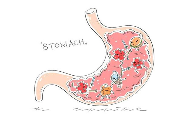 慢性胃炎要做胃鏡檢查嗎 慢性胃炎要做活檢嗎 慢性胃炎要做胃鏡檢查嗎 慢性胃炎要做活檢嗎