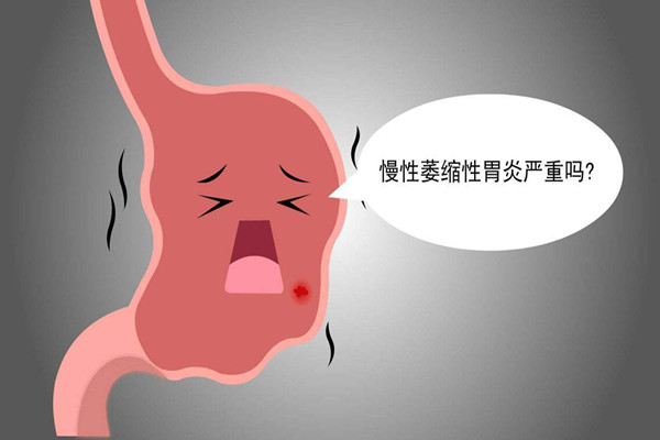 慢性胃炎有幾種類型 慢性胃炎哪種最嚴重 慢性胃炎有幾種類型 慢性胃炎哪種最嚴重