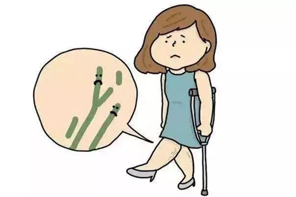 靜脈曲張會(huì)死人嗎 靜脈曲張用什么辦法治療最好 靜脈曲張會(huì)死人嗎 靜脈曲張用什么辦法治療最好