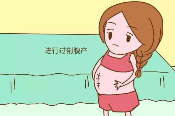 剖腹產(chǎn)的傷疤可以去掉嗎 剖腹產(chǎn)的刀疤一般多久會徹底恢復(fù) 剖腹產(chǎn)的傷疤可以去掉嗎 剖腹產(chǎn)的刀疤一般多久會徹底恢復(fù)