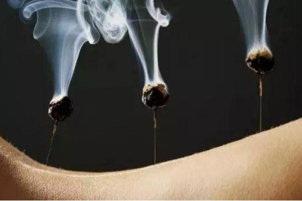 艾灸是怎么做的 是否每天都要艾灸 艾灸是怎么做的 是否每天都要艾灸