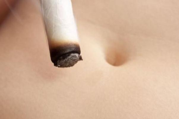 艾灸會導致流產(chǎn)嗎 艾灸對痛風有治療作用嗎 艾灸會導致流產(chǎn)嗎 艾灸對痛風有治療作用嗎