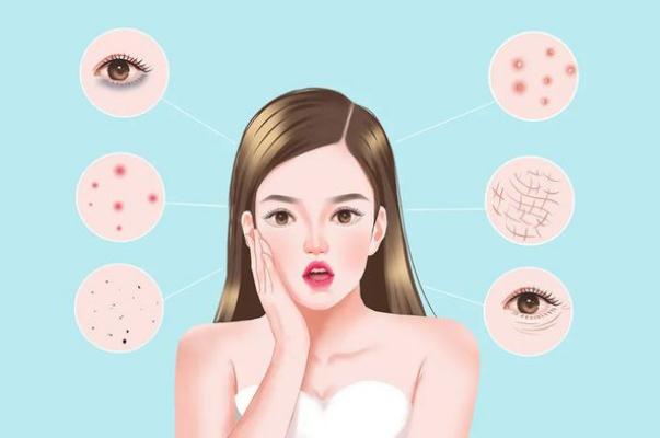 刷酸可以收縮毛孔嗎 刷酸后臉上長(zhǎng)了好多小痘痘 刷酸可以收縮毛孔嗎 刷酸后臉上長(zhǎng)了好多小痘痘