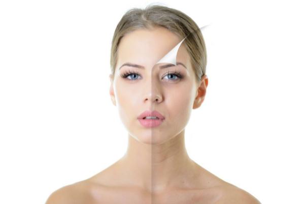 刷酸有什么好處和壞處 刷酸有刺痛感正常嗎 刷酸有什么好處和壞處 刷酸有刺痛感正常嗎