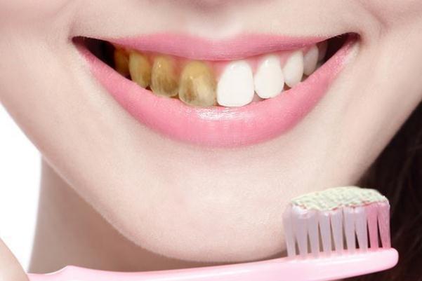 牙黃怎么變白簡單方法 牙黃是什么原因?qū)е碌? alt=