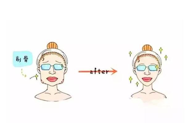 削骨瘦臉風險大嗎 削骨瘦臉多久可以恢復 削骨瘦臉風險大嗎 削骨瘦臉多久可以恢復