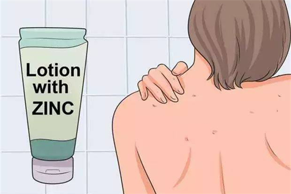 雞皮膚會(huì)隨著年齡的增長消除嗎 雞皮膚用什么藥膏最好 雞皮膚會(huì)隨著年齡的增長消除嗎 雞皮膚用什么藥膏最好