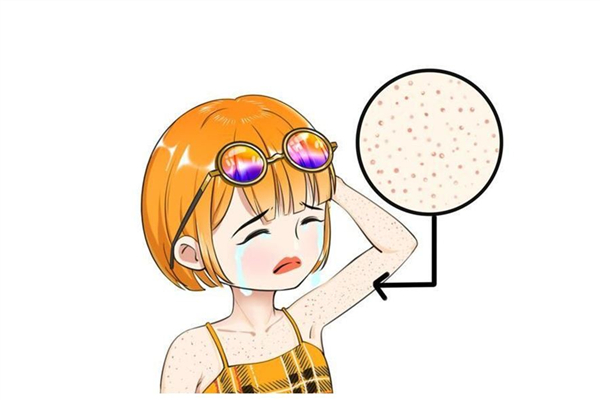 雞皮膚能不能治好 雞皮膚如何治療 雞皮膚能不能治好 雞皮膚如何治療