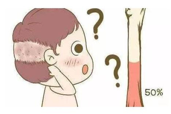 嬰兒枕禿要緊嗎 嬰兒枕禿多久恢復正常 嬰兒枕禿要緊嗎 嬰兒枕禿多久恢復正常