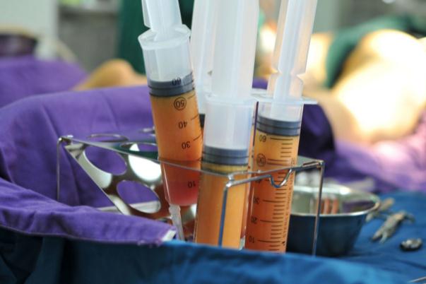 抽脂肪的后遺癥 抽脂肪是怎么抽出來(lái)的 抽脂肪的后遺癥 抽脂肪是怎么抽出來(lái)的