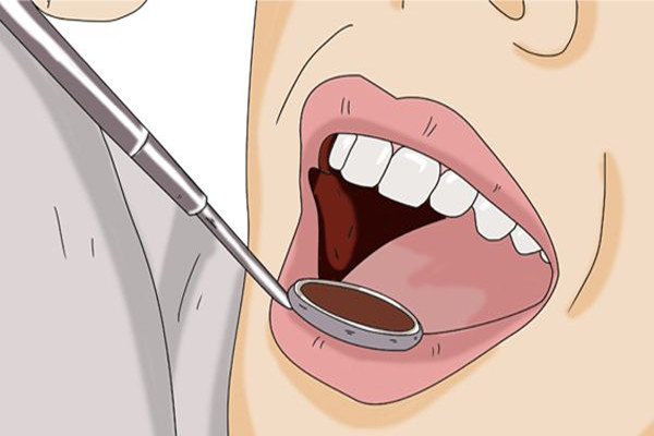 戴牙套能不能洗牙 戴牙套洗牙好嗎 戴牙套能不能洗牙 戴牙套洗牙好嗎