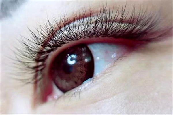 種睫毛后眼睛又腫又癢怎么回事 種睫毛后為什么眼睛水腫了 種睫毛后眼睛又腫又癢怎么回事 種睫毛后為什么眼睛水腫了