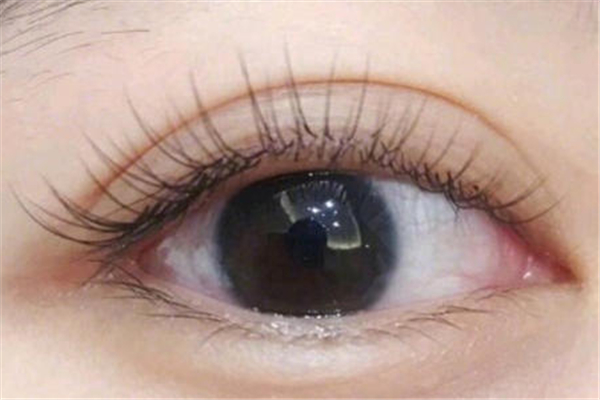 種睫毛后眼睛會變大嗎 種睫毛的好處和壞處 種睫毛后眼睛會變大嗎 種睫毛的好處和壞處