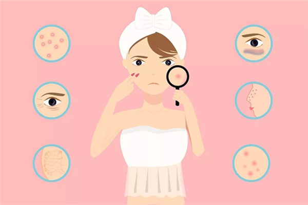 閉口和粉刺的區(qū)別 閉口和粉刺是一樣的嗎 閉口和粉刺的區(qū)別 閉口和粉刺是一樣的嗎