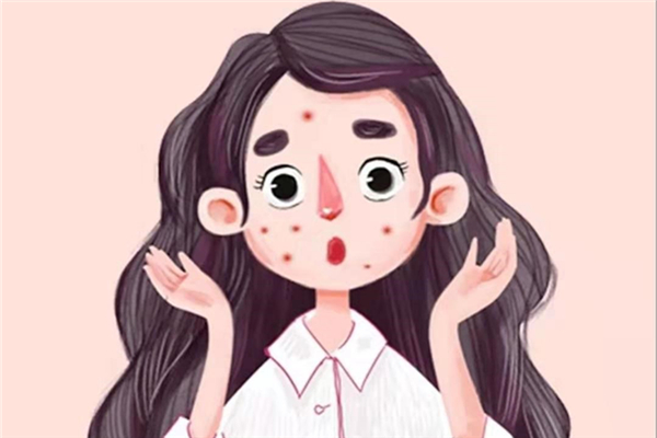 閉口粉刺怎么可以有效去除 閉口粉刺是什么原因引起的 閉口粉刺怎么可以有效去除 閉口粉刺是什么原因引起的