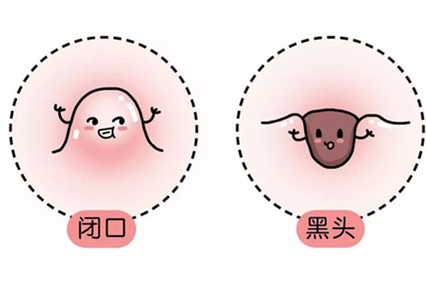 閉口長啥樣 閉口怎么除 閉口長啥樣 閉口怎么除