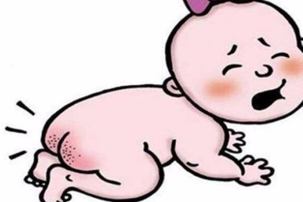 寶寶紅屁股要多久才會(huì)好 寶寶紅屁股會(huì)自愈嗎 寶寶紅屁股要多久才會(huì)好 寶寶紅屁股會(huì)自愈嗎