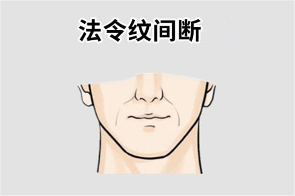 法令紋按摩能消除嗎 法令紋按摩哪個部位 法令紋按摩能消除嗎 法令紋按摩哪個部位