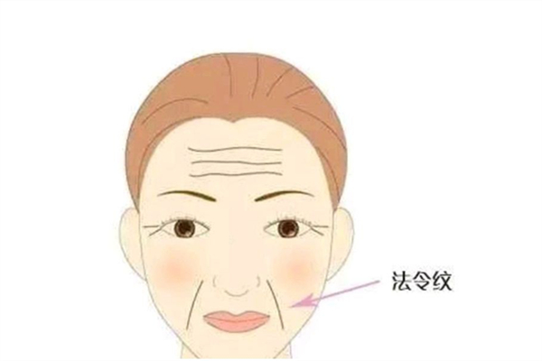 法令紋填充一般多少錢 法令紋填充用什么材料最好 法令紋填充一般多少錢 法令紋填充用什么材料最好