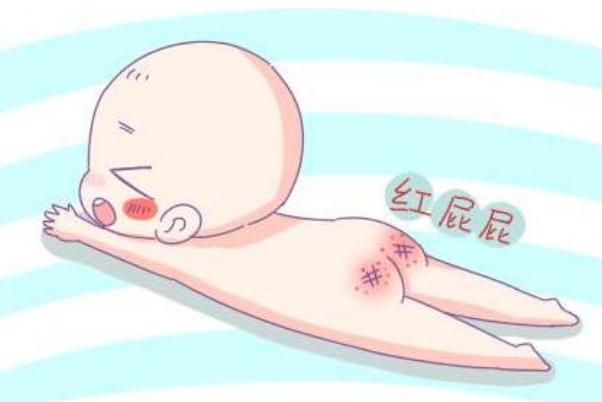 寶寶紅屁股要多久才會(huì)好 寶寶紅屁股會(huì)自愈嗎 寶寶紅屁股要多久才會(huì)好 寶寶紅屁股會(huì)自愈嗎