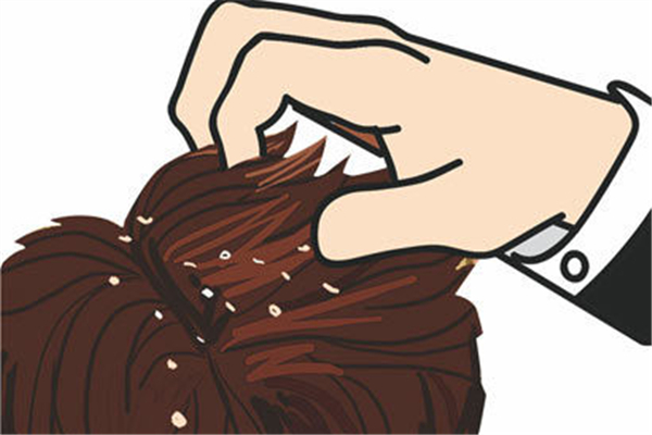 頭屑很多大塊是什么原因 大塊頭皮屑怎么治 頭屑很多大塊是什么原因 大塊頭皮屑怎么治