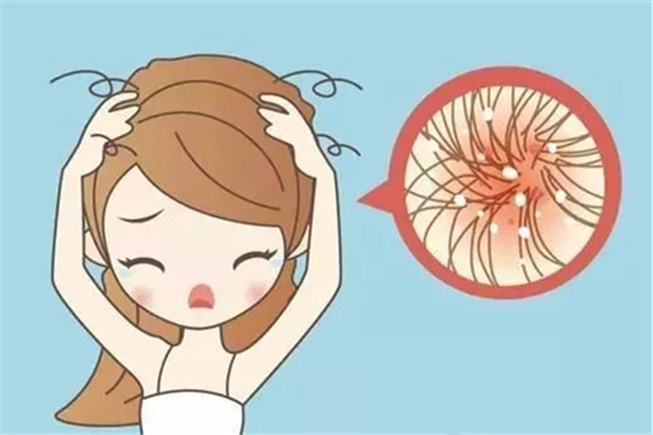 頭屑多是什么原因造成的 頭屑會影響頭發(fā)生長嗎 頭屑多是什么原因造成的 頭屑會影響頭發(fā)生長嗎
