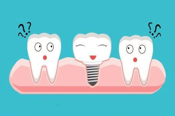 烤瓷牙是不是假牙 烤瓷牙是不是金屬 烤瓷牙是不是假牙 烤瓷牙是不是金屬